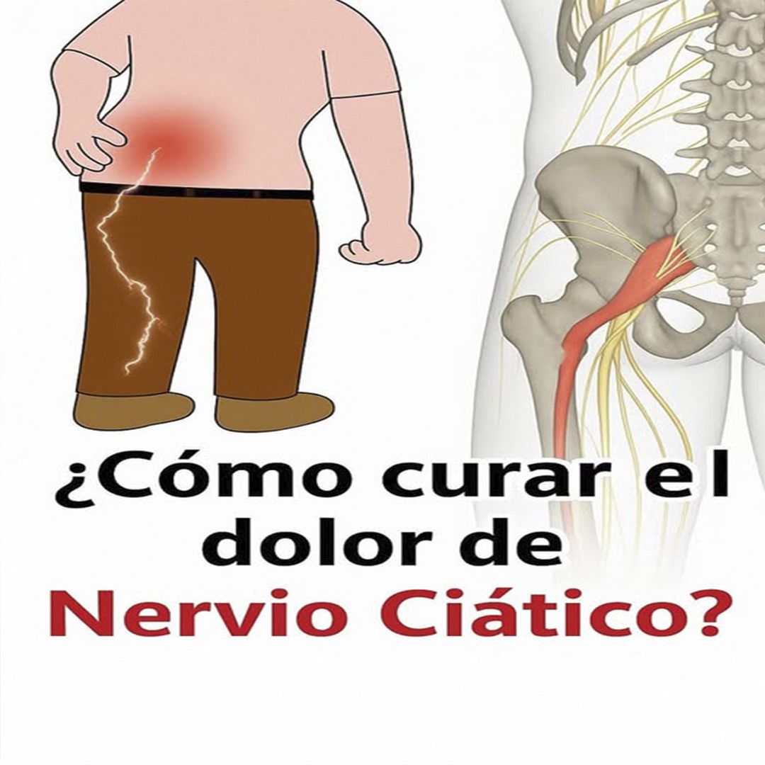 Dolor lumbar y ciática