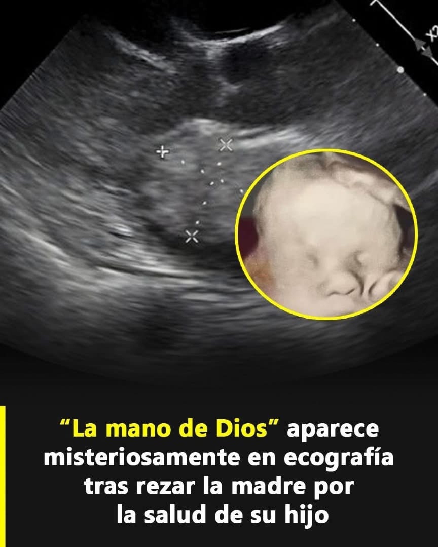 Ecografía muestra la mano de Dios protegiendo a un bebé