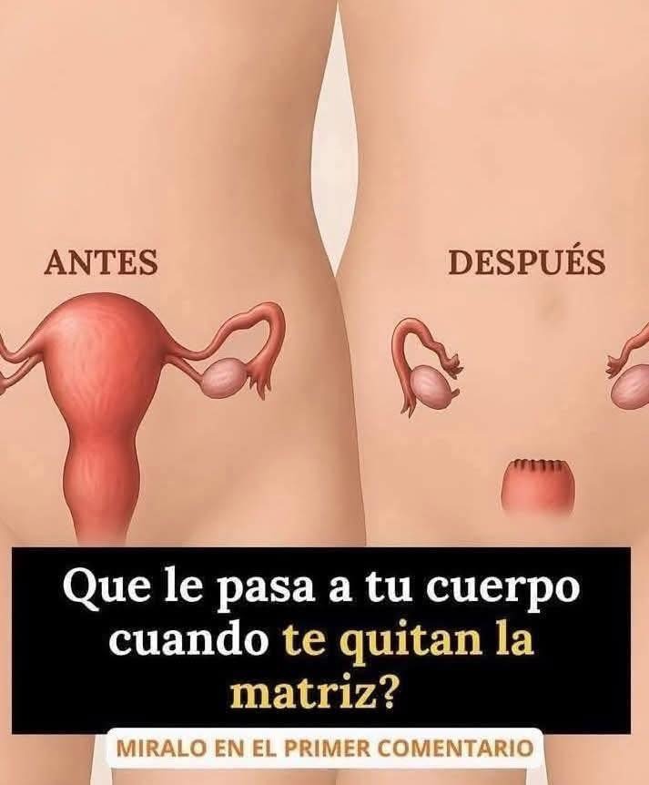 Comparación cuerpo antes y después de histerectomía