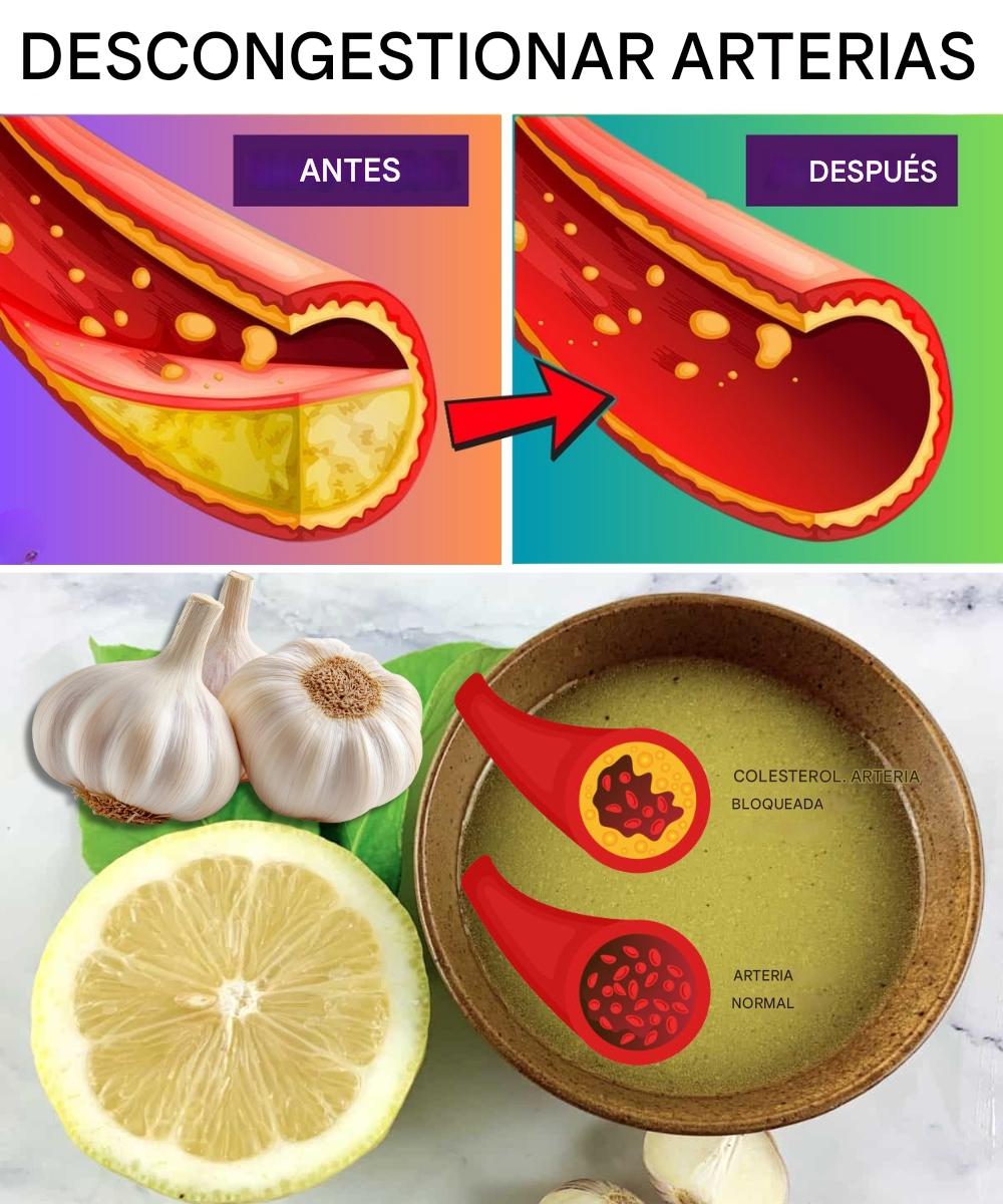 Remedios naturales para limpiar arterias