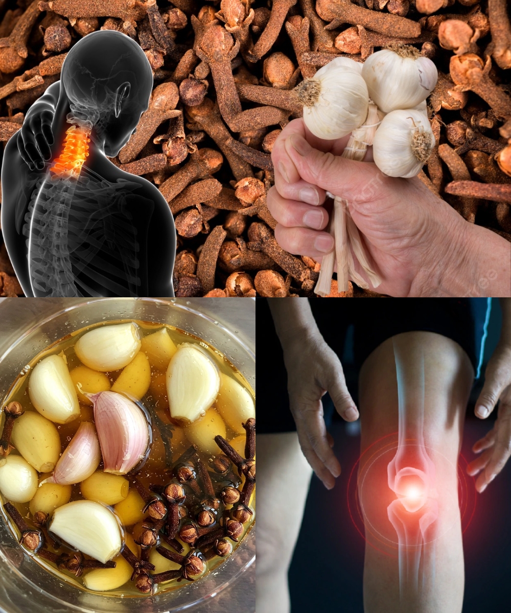 Remedios naturales con Ajo y Clavo