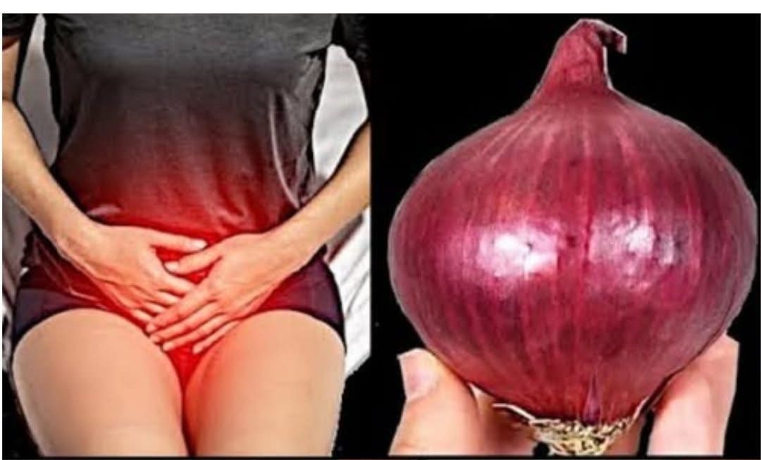 Beneficios de la cebolla para la salud de la próstata y vejiga