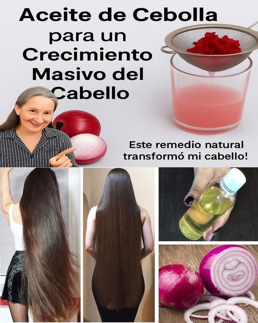 Aceite Casero de Cebolla Morada