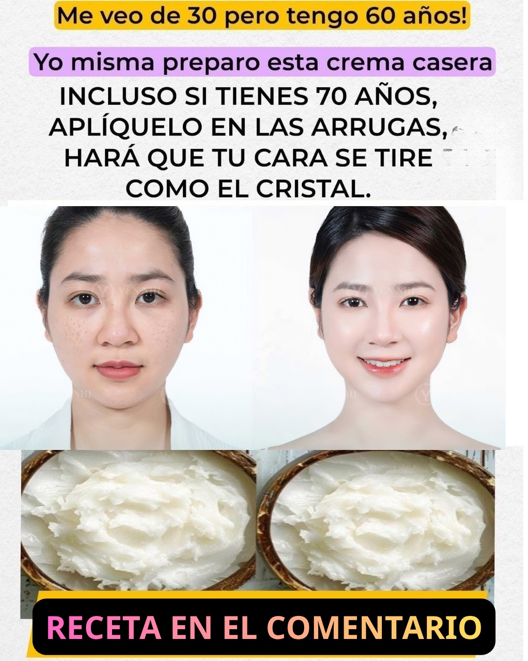 Crema Casera de Bicarbonato