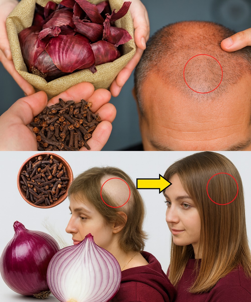 Cáscaras de cebolla y clavos de olor