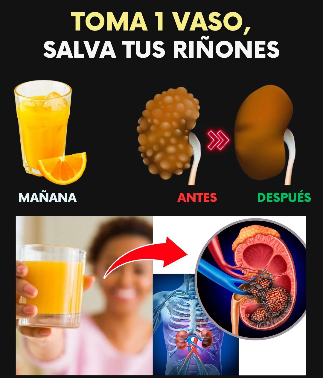 Jugo Dorado Renal
