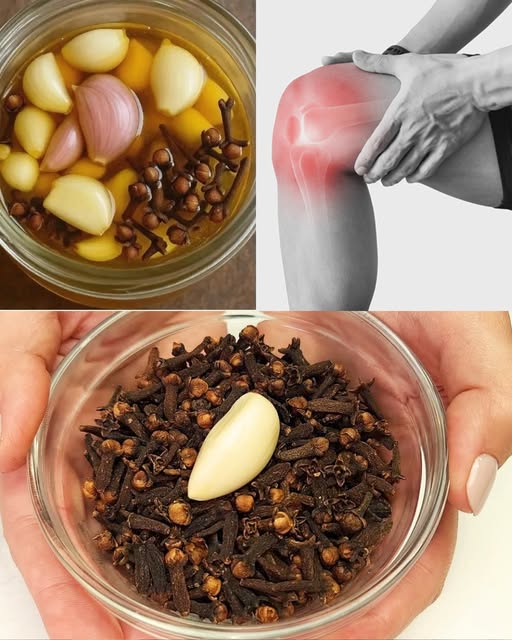 Remedios naturales para el dolor de piernas con ajo y clavo de olor