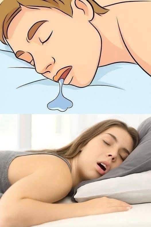 Persona durmiendo con saliva cayendo