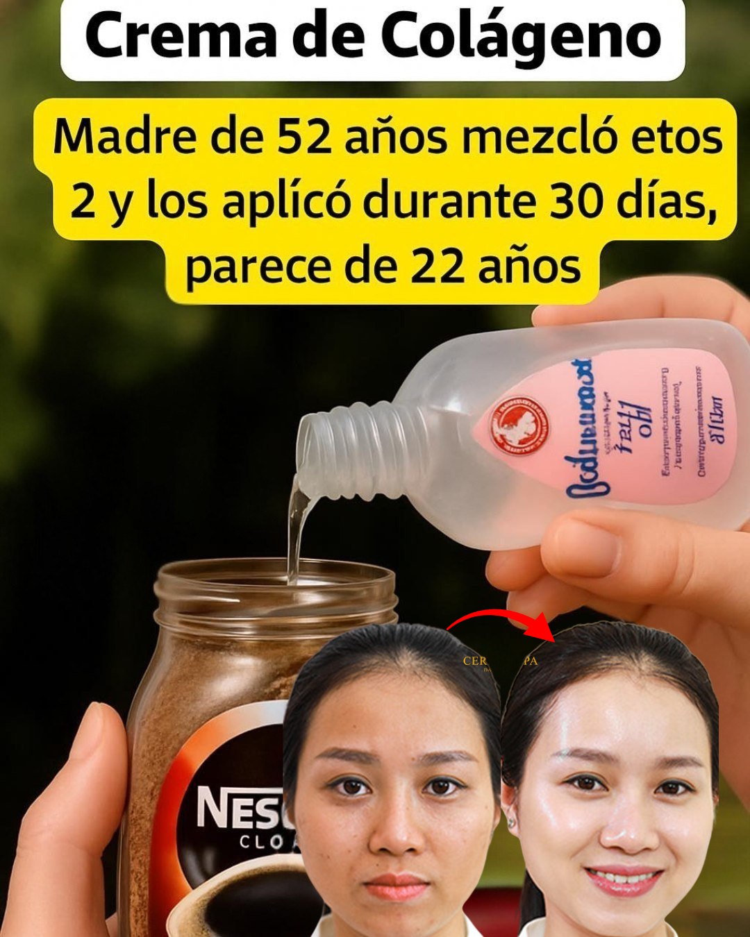 Antes y después de usar crema casera de colágeno
