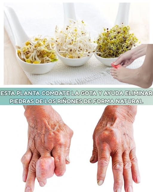 Alfalfa: Tu aliada natural para la salud renal