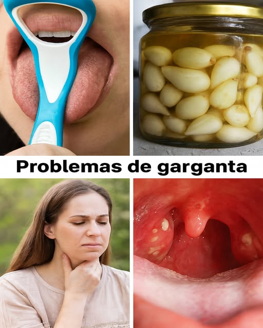 Ajo y remedios para problemas de garganta
